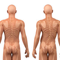 SPINAL DISORDERS=Scoliosis