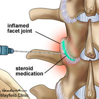 NON-SURGICAL TREATMENTS=Facet Injections and Rhizotomy