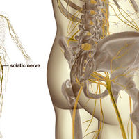 SPINAL DISORDERS=Sciatica